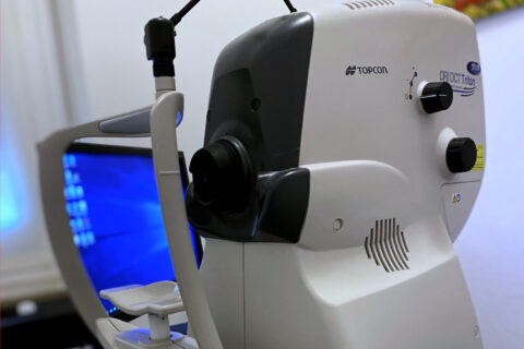 OCT maculare e glaucoma