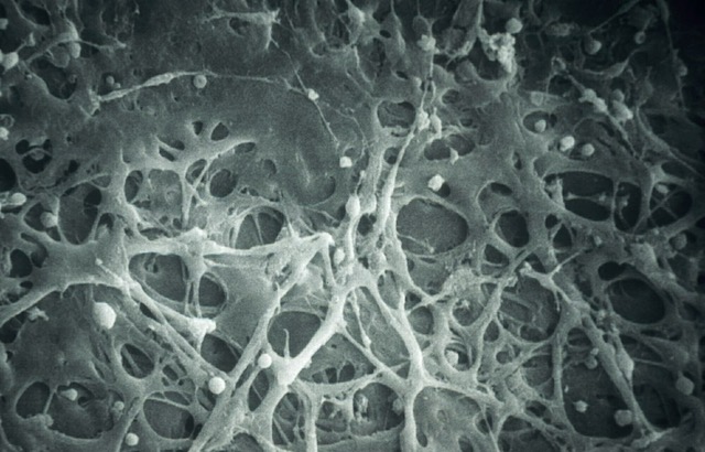 trabecolato al microscopio
